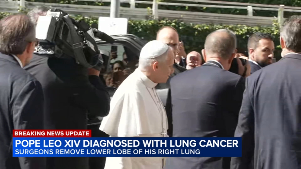Pope surgery update: Vatican says Pope Leo XIV has lung cancer and the lower lobe of his right lung was removed
       — ABC 7 Bay Area