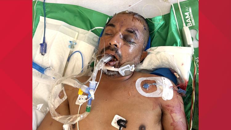 University Hospital asks for help identifying unconscious patient hit by truck Saturday evening — KENS 5 (San Antonio), St. Helena Health news