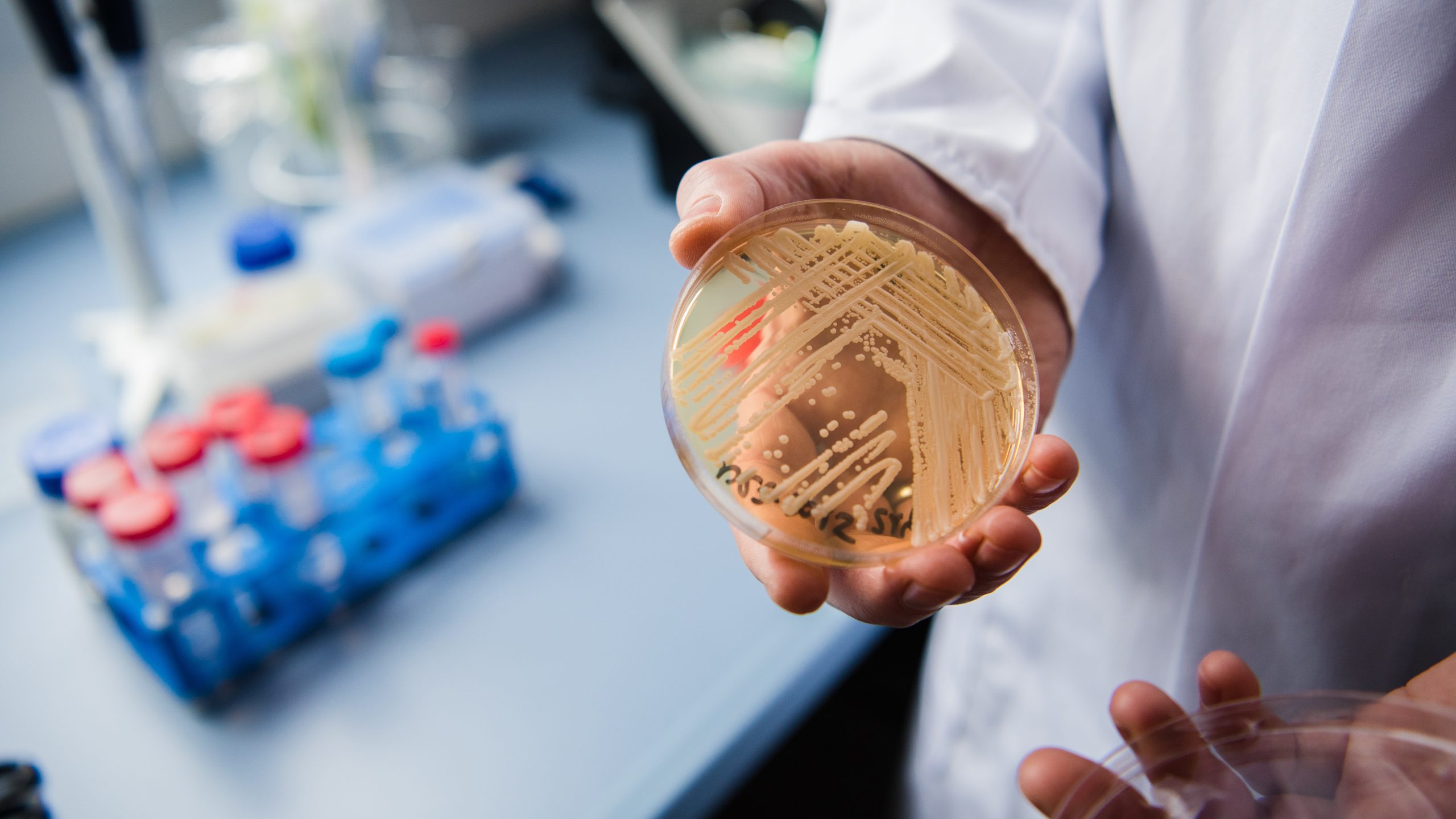 New study reveals why dangerous fungus is so difficult to treat — KTVU FOX 2 Bay Area, St. Helena Community news